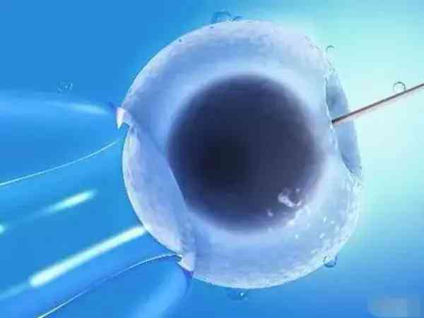 费用与试管婴儿的经济影响